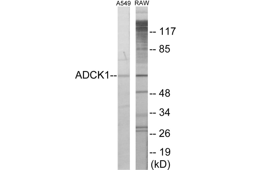 Western Blot - ADCK1 Cell Based ELISA Kit (CB6071) - Antibodies.com