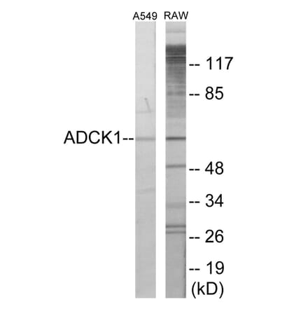 Western Blot - ADCK1 Cell Based ELISA Kit (CB6071) - Antibodies.com