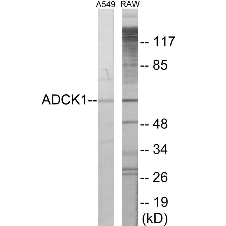 Western Blot - ADCK1 Cell Based ELISA Kit (CB6071) - Antibodies.com