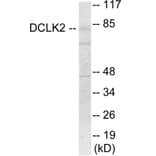 Western Blot - DCLK2 Cell Based ELISA Kit (CB6080) - Antibodies.com