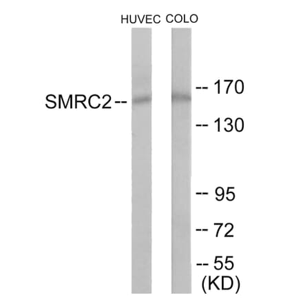 Western Blot - SMRC2 Cell Based ELISA Kit (CB6088) - Antibodies.com