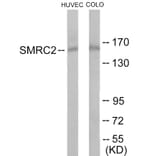 Western Blot - SMRC2 Cell Based ELISA Kit (CB6088) - Antibodies.com