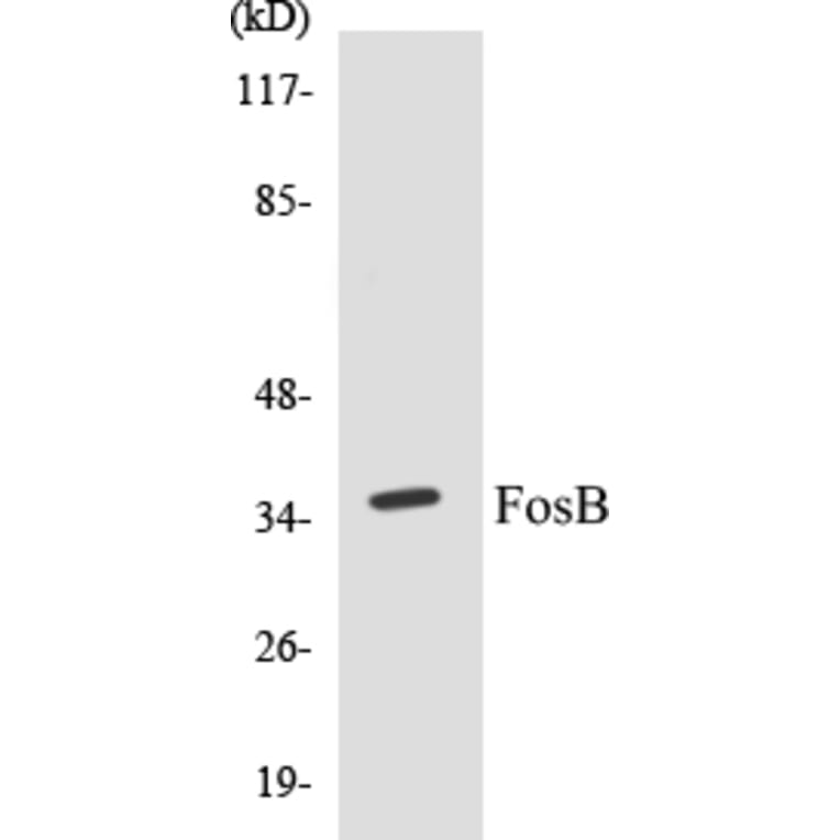 Western Blot - FosB Cell Based ELISA Kit (CB5273) - Antibodies.com
