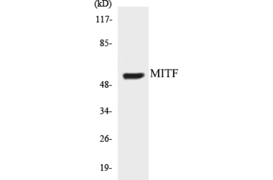 Western Blot - MITF Cell Based ELISA Kit (CB5450) - Antibodies.com