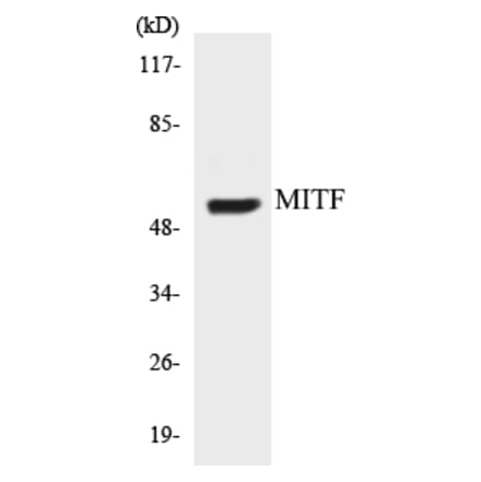 Western Blot - MITF Cell Based ELISA Kit (CB5450) - Antibodies.com
