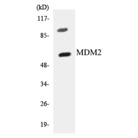 Western Blot - MDM2 Cell Based ELISA Kit (CB5436) - Antibodies.com