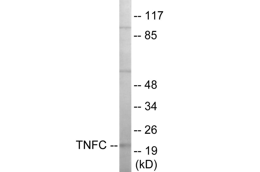 Western Blot - TNFC Cell Based ELISA Kit (CB5964) - Antibodies.com