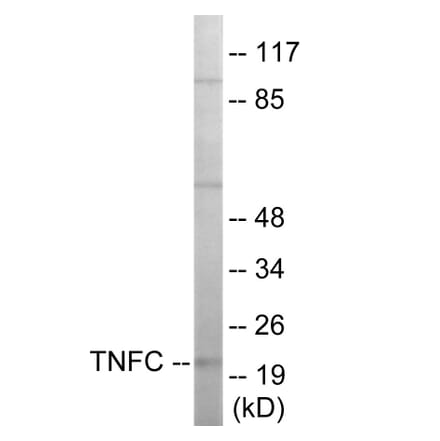 Western Blot - TNFC Cell Based ELISA Kit (CB5964) - Antibodies.com