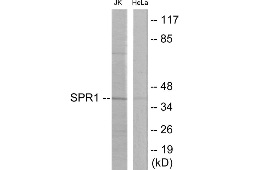 Western Blot - SPR1 Cell Based ELISA Kit (CB6031) - Antibodies.com