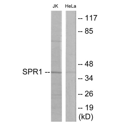 Western Blot - SPR1 Cell Based ELISA Kit (CB6031) - Antibodies.com