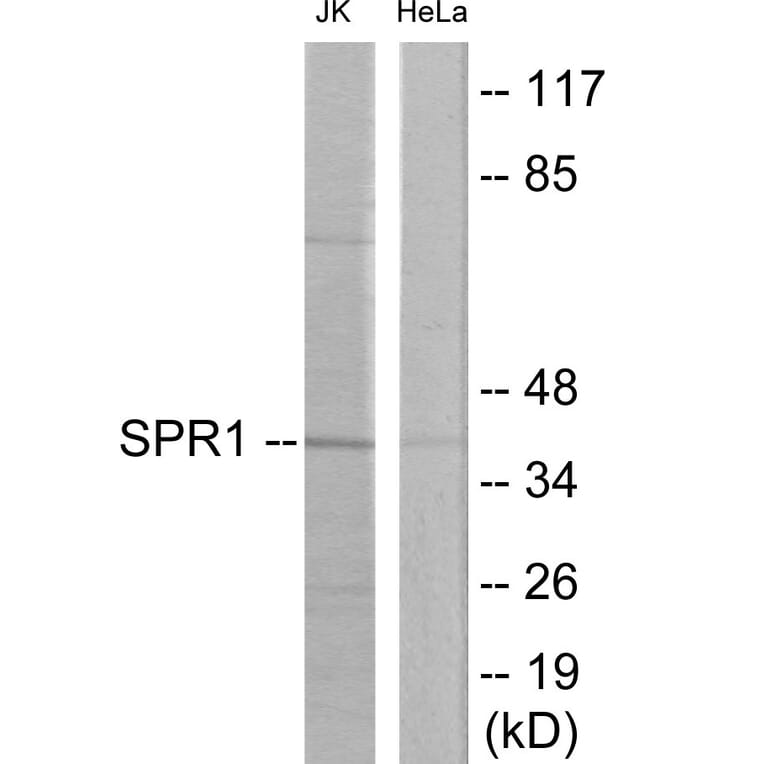 Western Blot - SPR1 Cell Based ELISA Kit (CB6031) - Antibodies.com