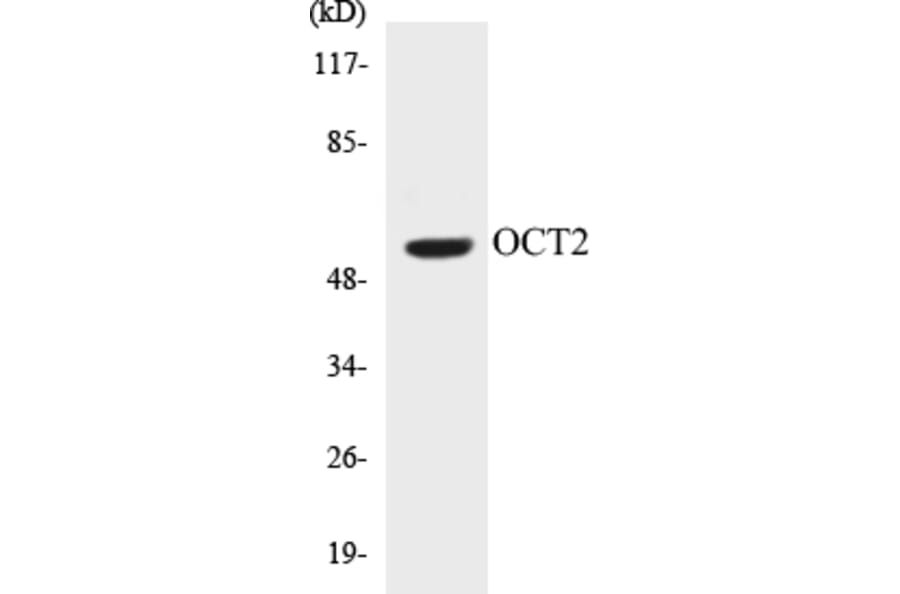 Western Blot - OCT2 Cell Based ELISA Kit (CB5006) - Antibodies.com
