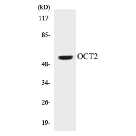 Western Blot - OCT2 Cell Based ELISA Kit (CB5006) - Antibodies.com