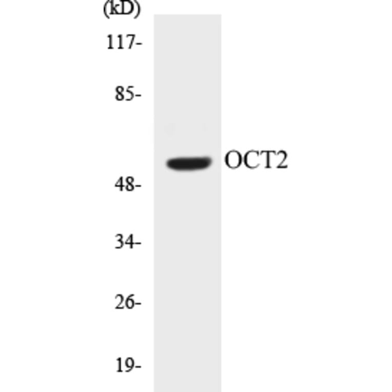Western Blot - OCT2 Cell Based ELISA Kit (CB5006) - Antibodies.com