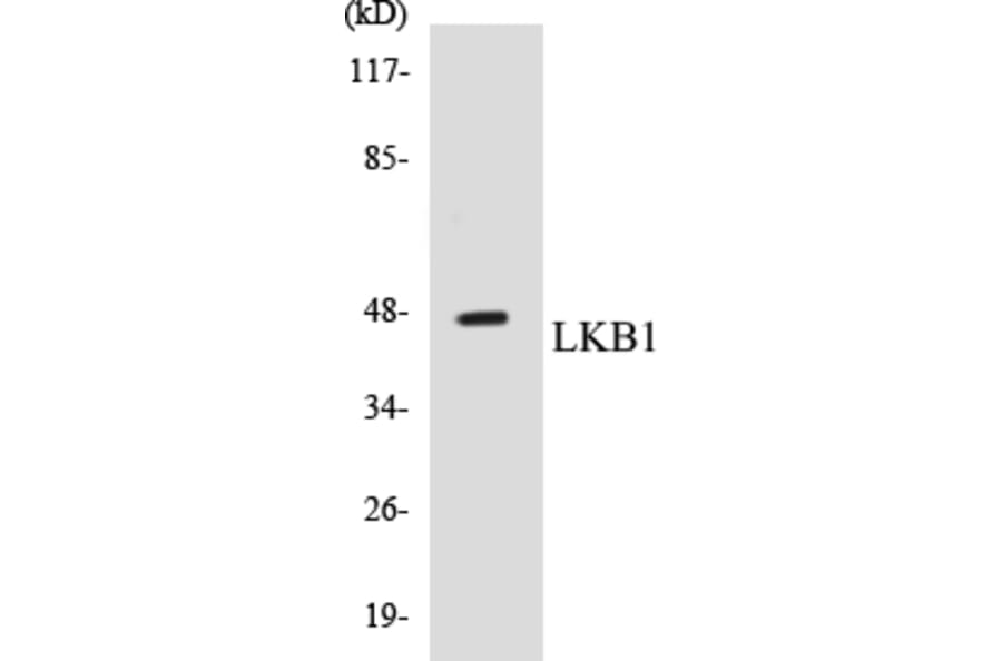 Western Blot - LKB1 Cell Based ELISA Kit (CB5418) - Antibodies.com