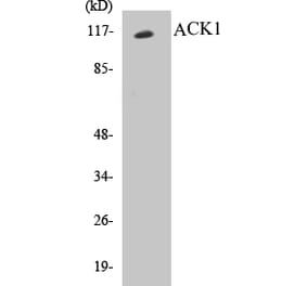 Western Blot - ACK1 Cell Based ELISA Kit (CB5018) - Antibodies.com