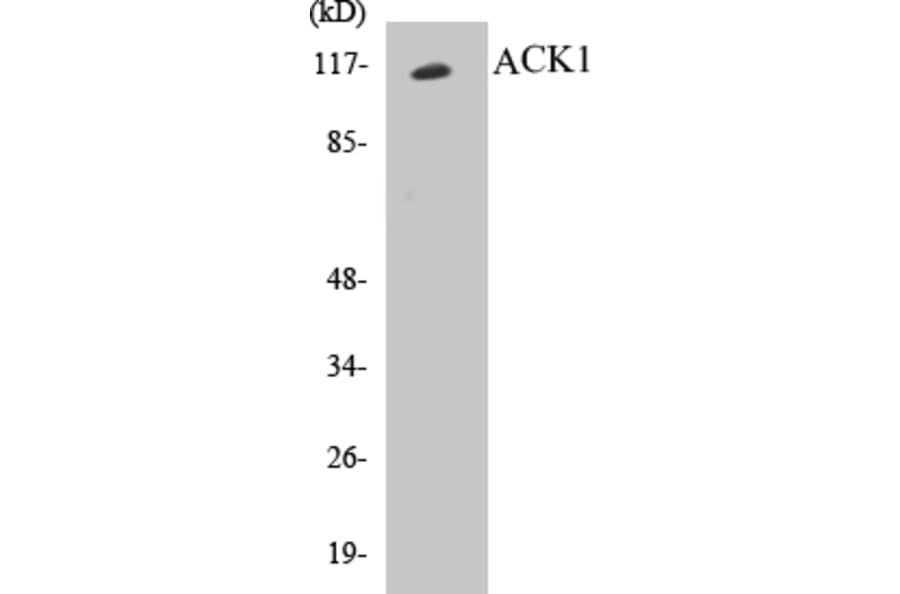 Western Blot - ACK1 Cell Based ELISA Kit (CB5018) - Antibodies.com