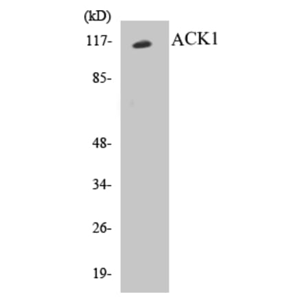 Western Blot - ACK1 Cell Based ELISA Kit (CB5018) - Antibodies.com