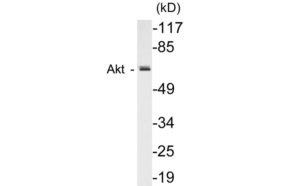 Western Blot - AIRE Cell Based ELISA Kit (CB5027) - Antibodies.com