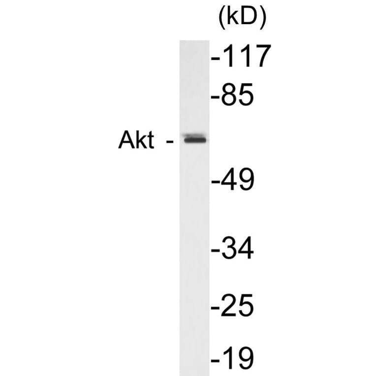 Western Blot - AIRE Cell Based ELISA Kit (CB5027) - Antibodies.com