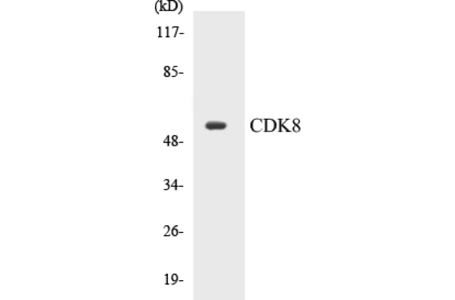 Western Blot - CDK8 Cell Based ELISA Kit (CB5133) - Antibodies.com