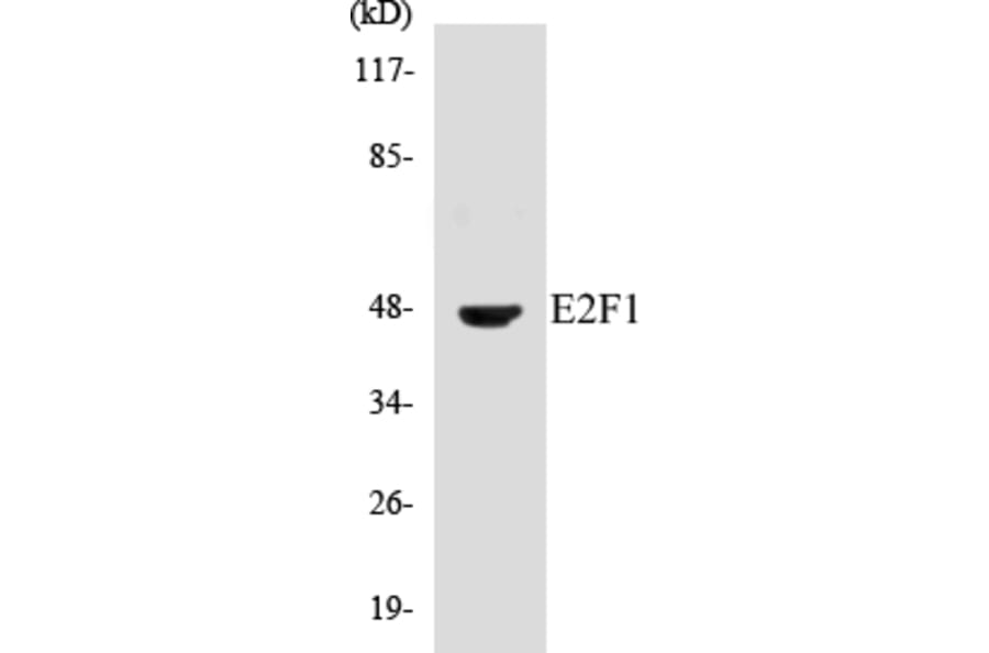 Western Blot - E2F1 Cell Based ELISA Kit (CB5215) - Antibodies.com