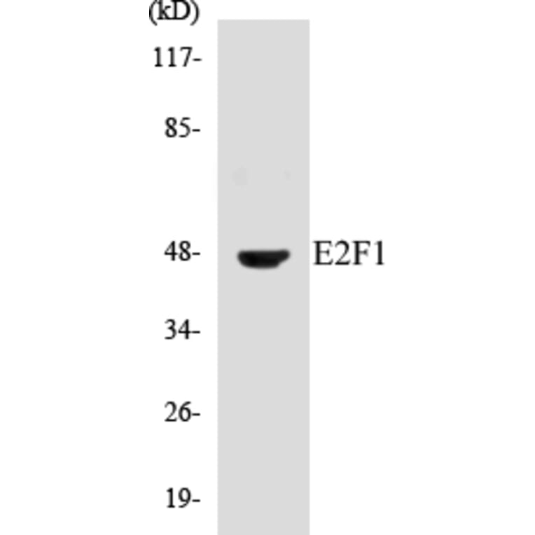 Western Blot - E2F1 Cell Based ELISA Kit (CB5215) - Antibodies.com