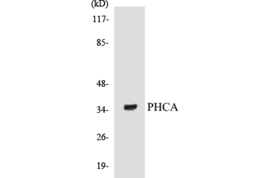 Western Blot - PHCA Cell Based ELISA Kit (CB5552) - Antibodies.com