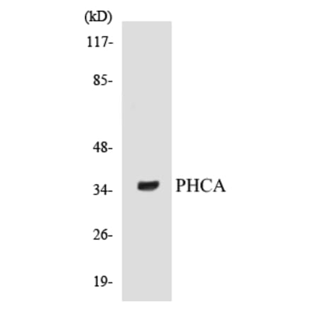 Western Blot - PHCA Cell Based ELISA Kit (CB5552) - Antibodies.com