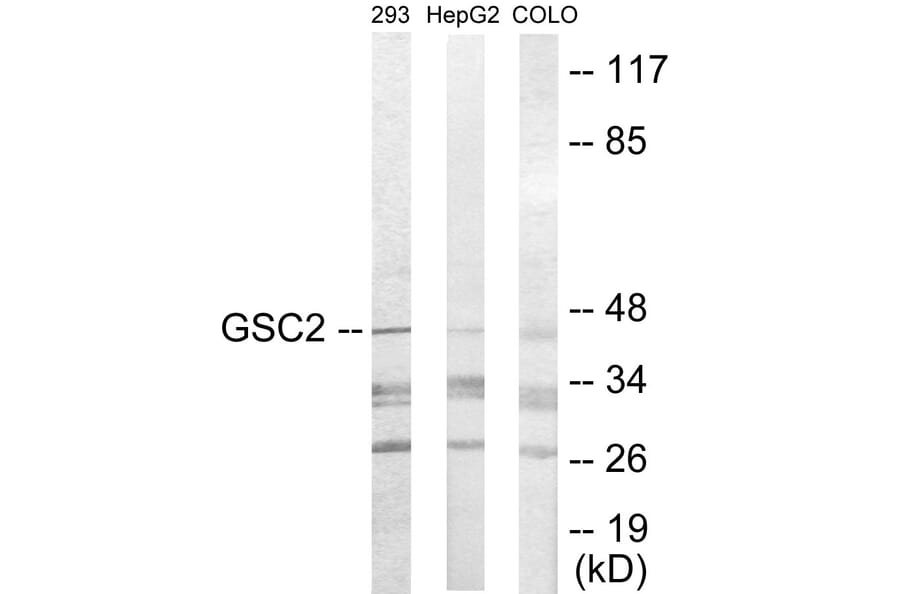 Western Blot - GSC2 Cell Based ELISA Kit (CB5779) - Antibodies.com