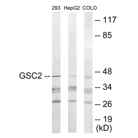 Western Blot - GSC2 Cell Based ELISA Kit (CB5779) - Antibodies.com