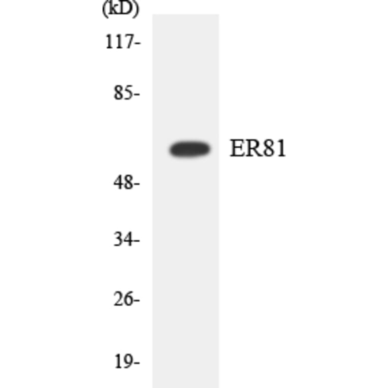 Western Blot - ER81 Cell Based ELISA Kit (CB5905) - Antibodies.com