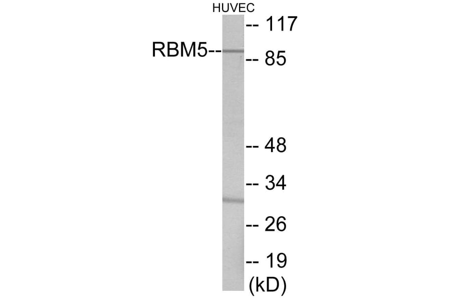 Western Blot - RBM5 Cell Based ELISA Kit (CB5917) - Antibodies.com
