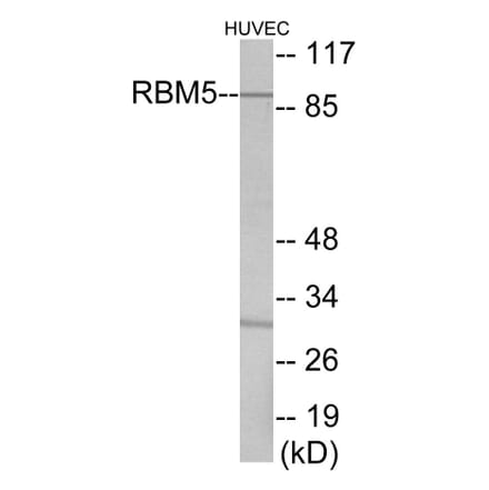 Western Blot - RBM5 Cell Based ELISA Kit (CB5917) - Antibodies.com