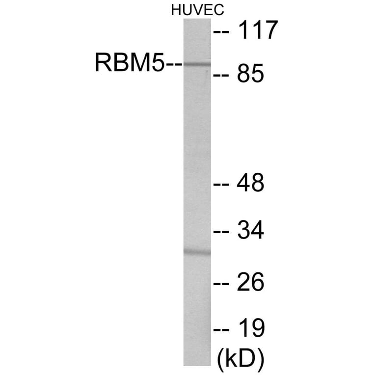 Western Blot - RBM5 Cell Based ELISA Kit (CB5917) - Antibodies.com