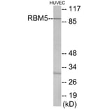 Western Blot - RBM5 Cell Based ELISA Kit (CB5917) - Antibodies.com