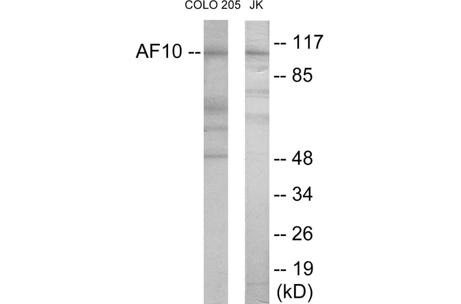 Western Blot - AF10 Cell Based ELISA Kit (CB5925) - Antibodies.com