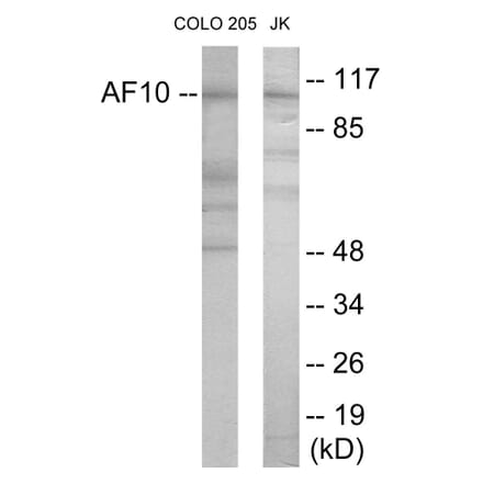 Western Blot - AF10 Cell Based ELISA Kit (CB5925) - Antibodies.com