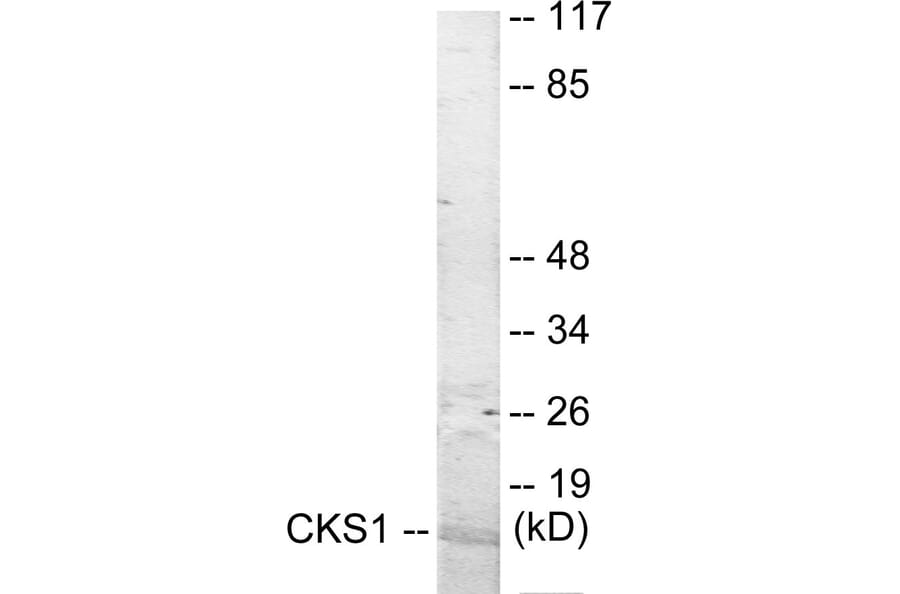 Western Blot - CKS1 Cell Based ELISA Kit (CB5933) - Antibodies.com