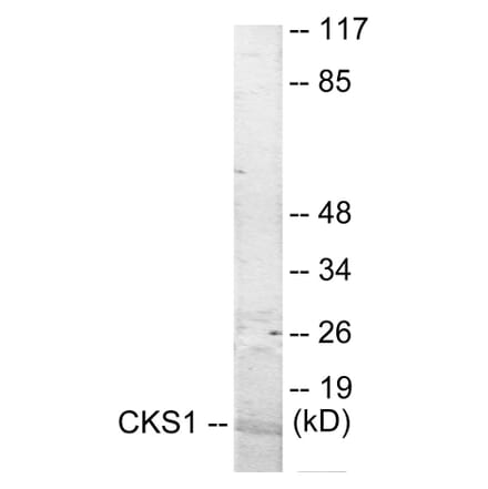 Western Blot - CKS1 Cell Based ELISA Kit (CB5933) - Antibodies.com