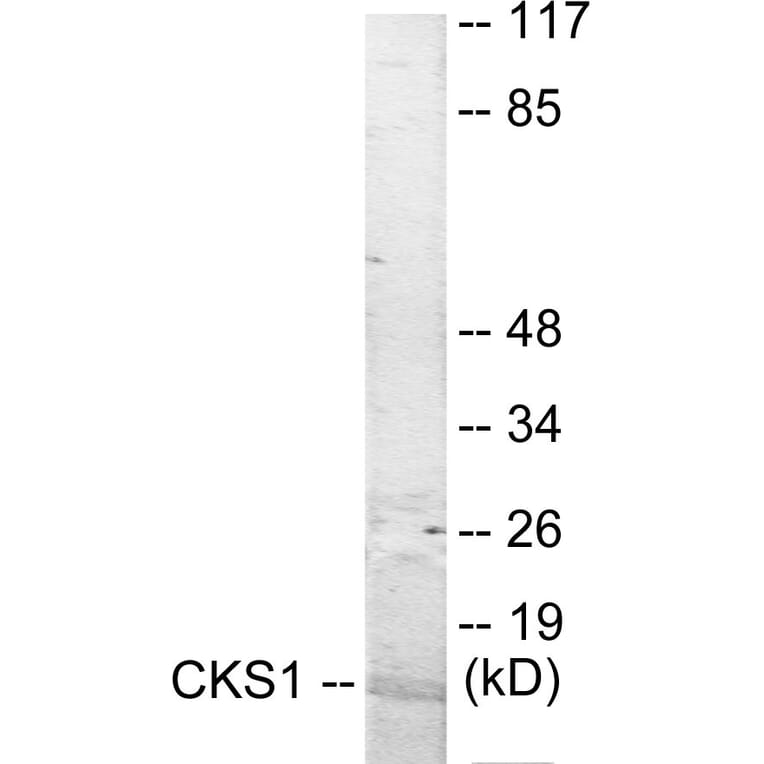 Western Blot - CKS1 Cell Based ELISA Kit (CB5933) - Antibodies.com