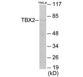 Western Blot - TBX2 Cell Based ELISA Kit (CB5982) - Antibodies.com