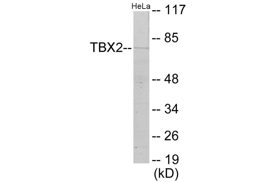 Western Blot - TBX2 Cell Based ELISA Kit (CB5982) - Antibodies.com