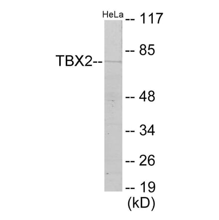 Western Blot - TBX2 Cell Based ELISA Kit (CB5982) - Antibodies.com
