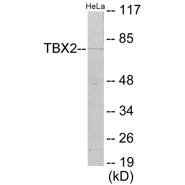 Western Blot - TBX2 Cell Based ELISA Kit (CB5982) - Antibodies.com