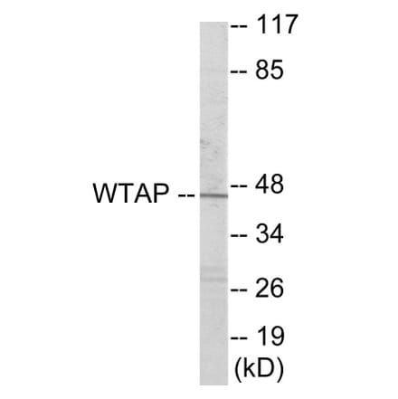 Western Blot - WTAP Cell Based ELISA Kit (CB6011) - Antibodies.com