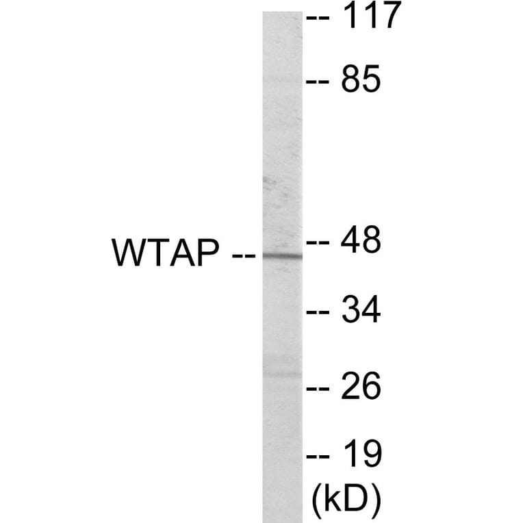 Western Blot - WTAP Cell Based ELISA Kit (CB6011) - Antibodies.com