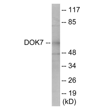 Western Blot - DOK7 Cell Based ELISA Kit (CB6044) - Antibodies.com