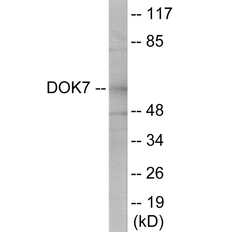 Western Blot - DOK7 Cell Based ELISA Kit (CB6044) - Antibodies.com