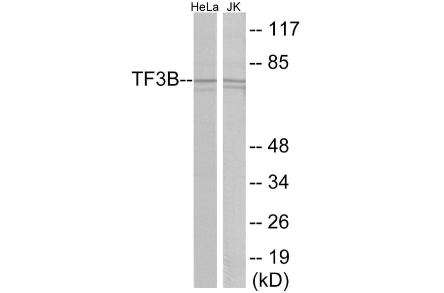 Western Blot - TF3B Cell Based ELISA Kit (CB6105) - Antibodies.com